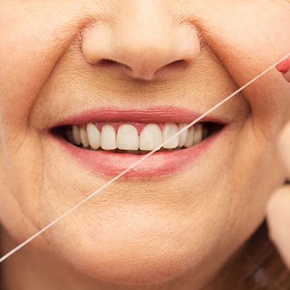 dental implants have important day to day benefits including easier cleaning for improved oral health