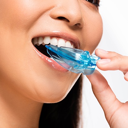 Protect your dental implants with a bite guard if you grind your teeth