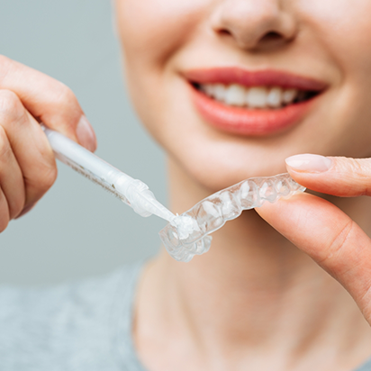 Person placing teeth whitening gel in a tray to be worn over the teeth