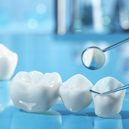 Dental bridge resting on a blue table