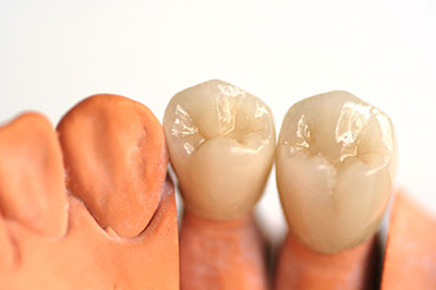Morgan Hill Dental Care | Pediatric Dentistry, Endodontics and Emergency Services