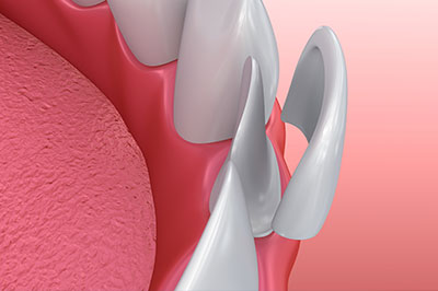 Morgan Hill Dental Care | Endodontics, Oral Surgery and Pediatric Dentistry