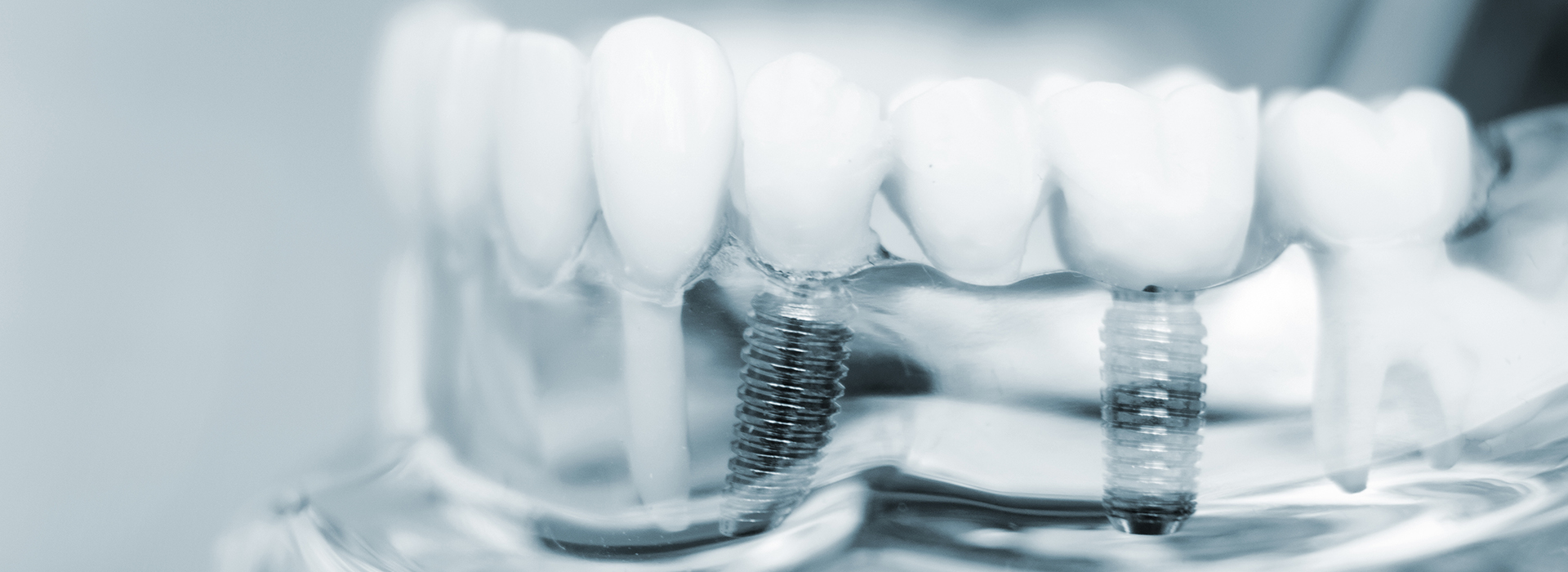 Morgan Hill Dental Care | Endodontics, Hygienist Services and Orthodontics